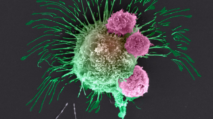 10 tips to prevent cancer in your day-to-day life