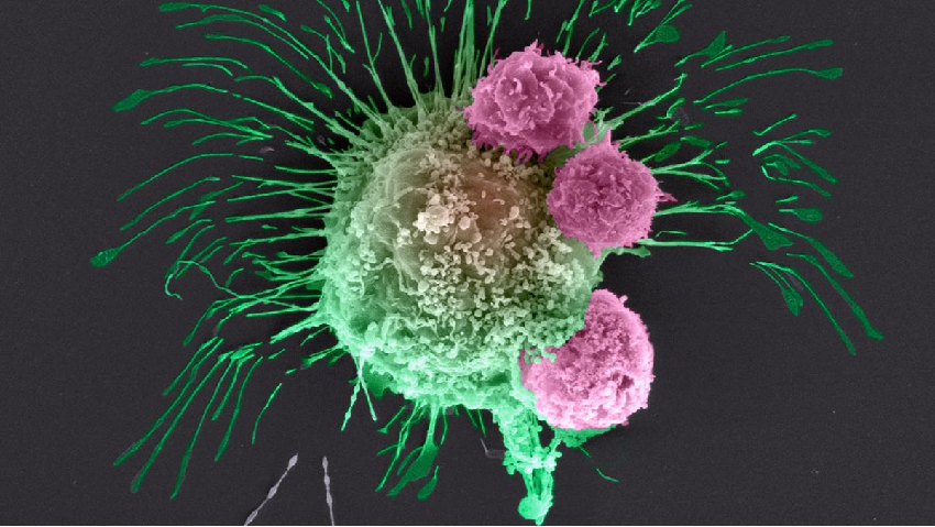 Prevent cancer on a daily basis