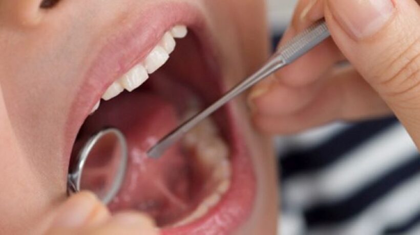 Tongue-Tie in Children: Signs, Solutions, and Supporting Healthy Development